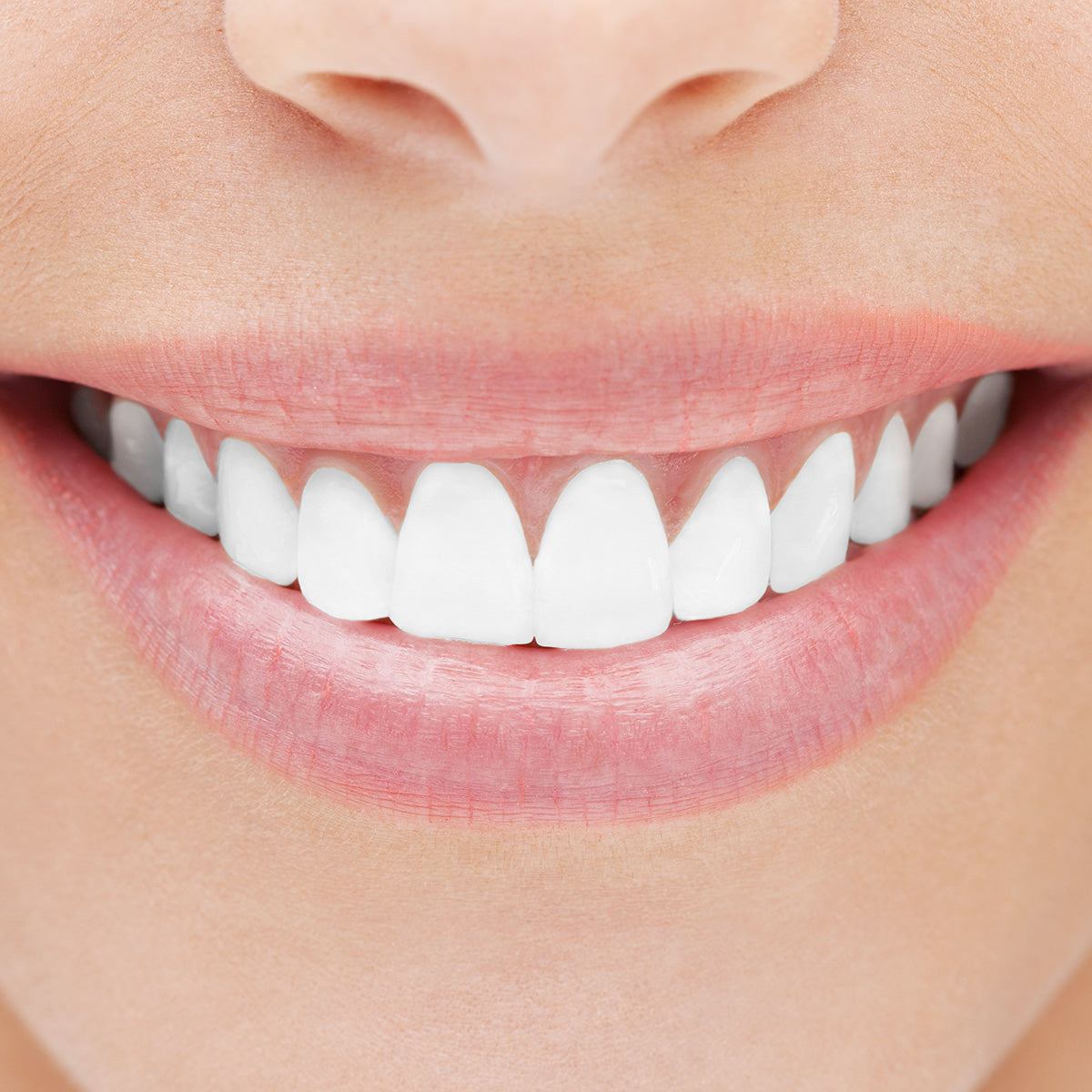 Healthy Gum Professional Teeth Whitening System - image 9