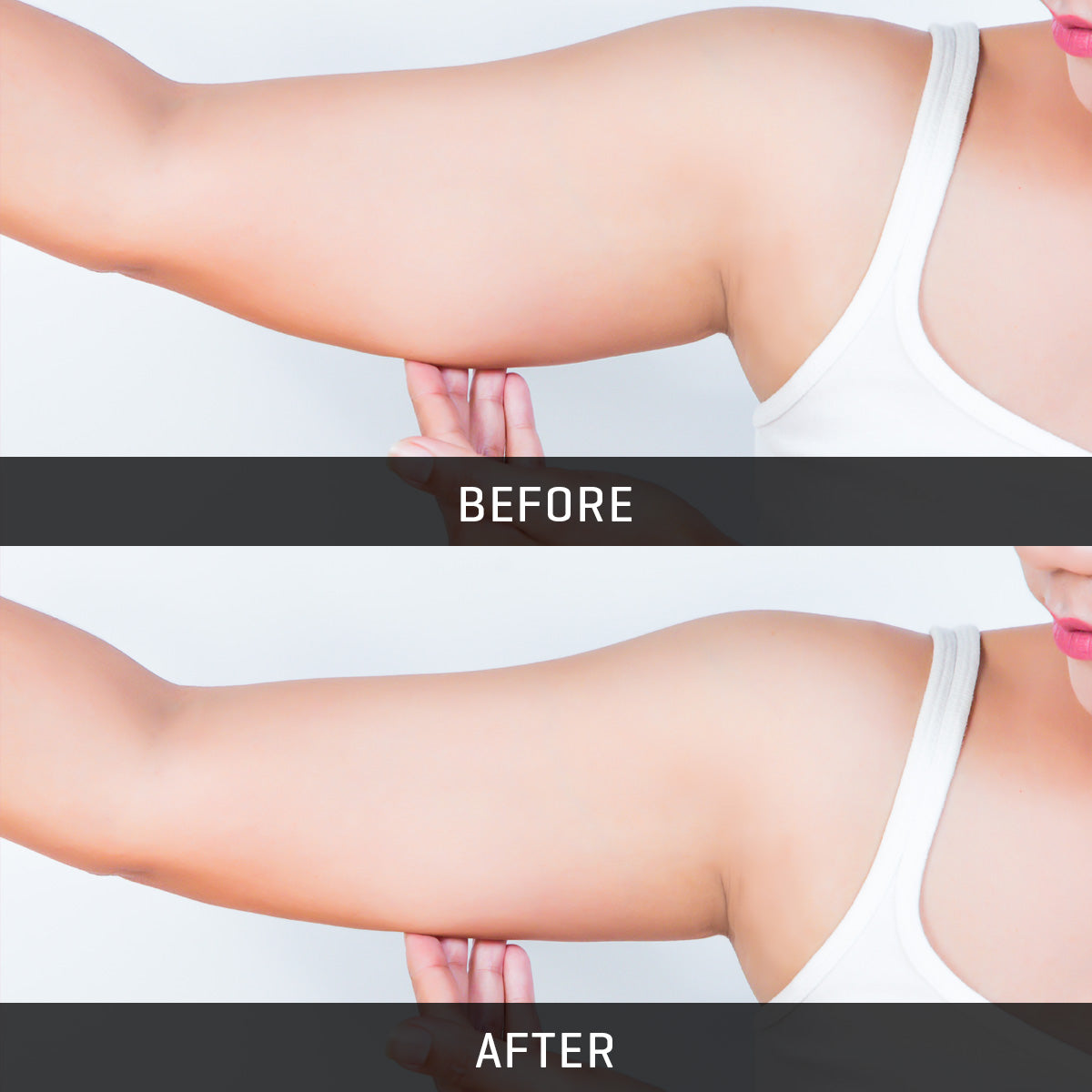 Underarm Toner - image 2