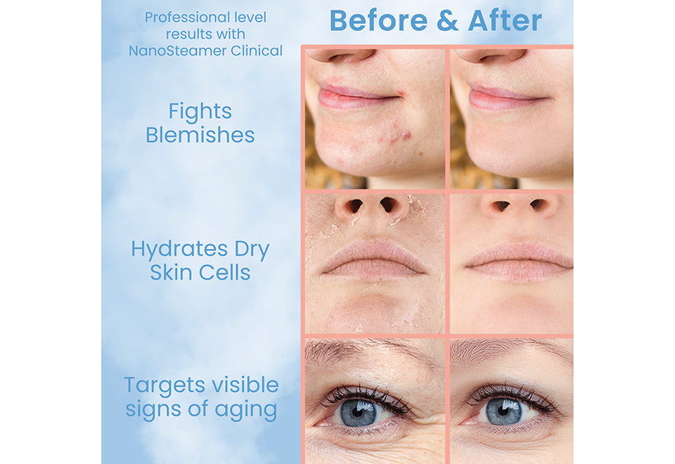 Professional Grade Facial Steamer - image 3