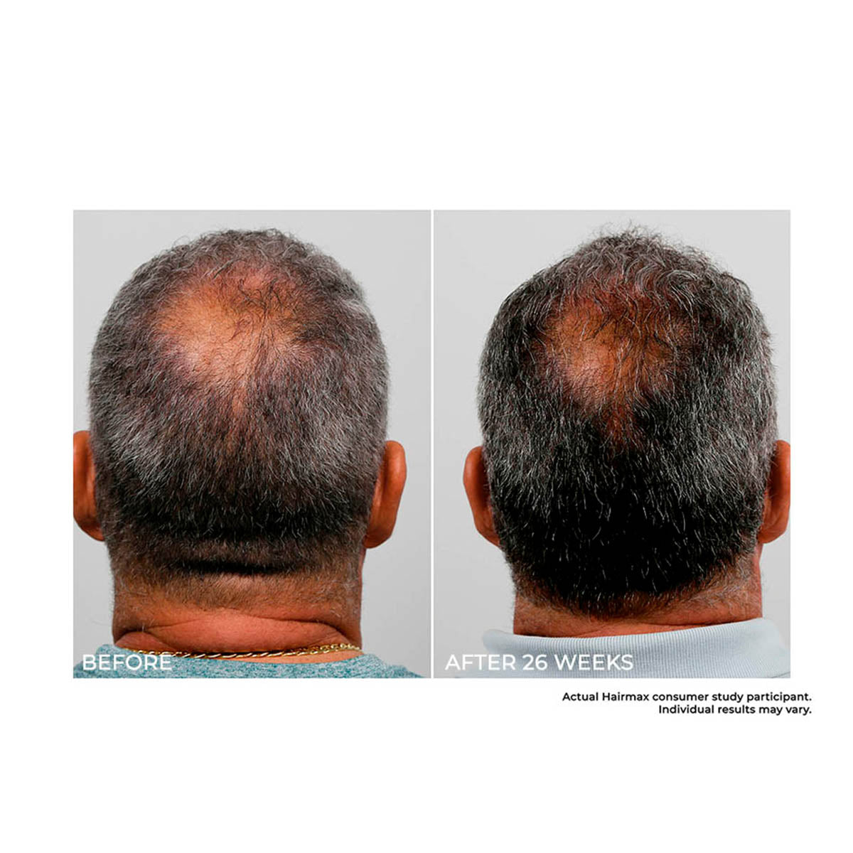 Cordless Hair Growth Comb - image 2