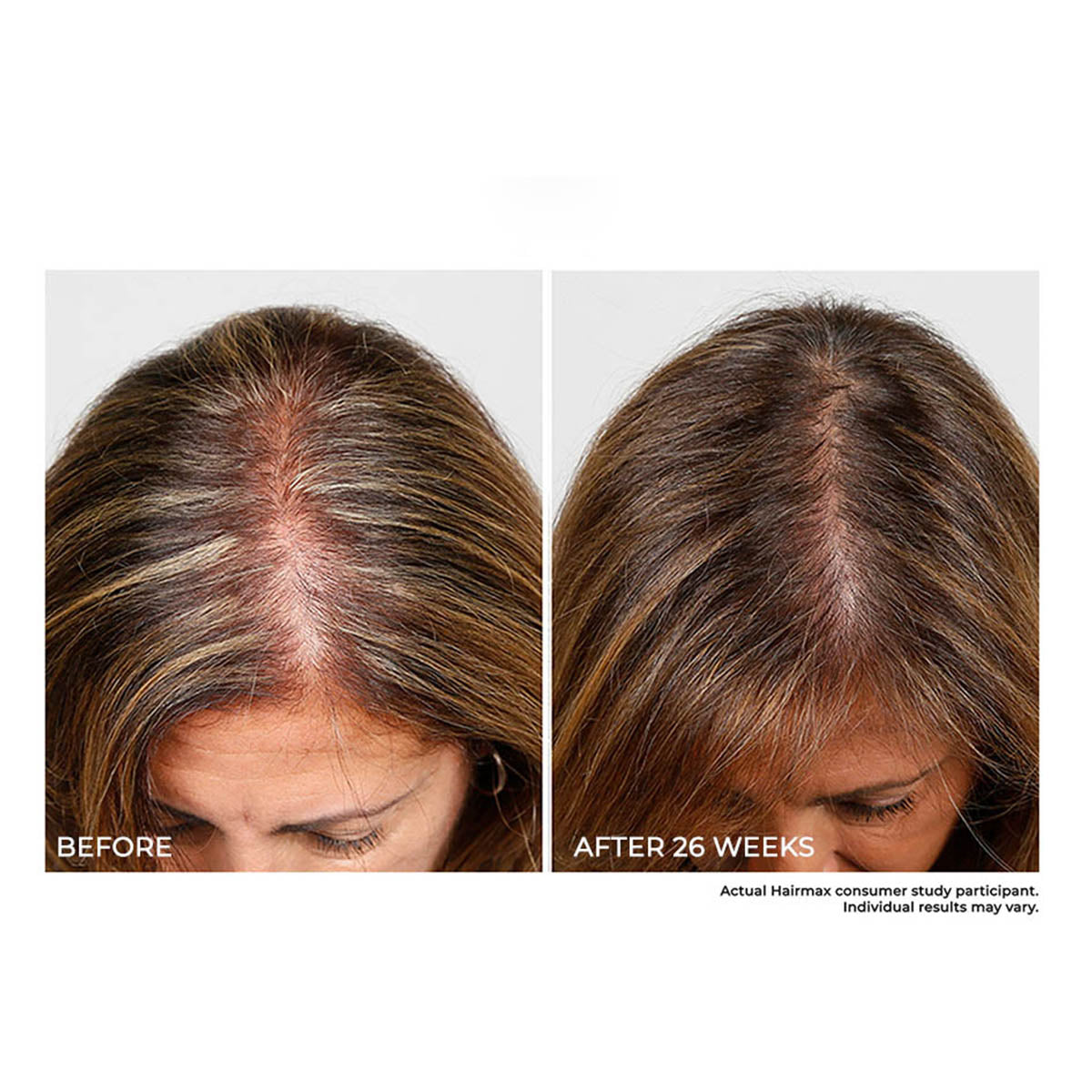 Cordless Hair Growth Comb - image 5