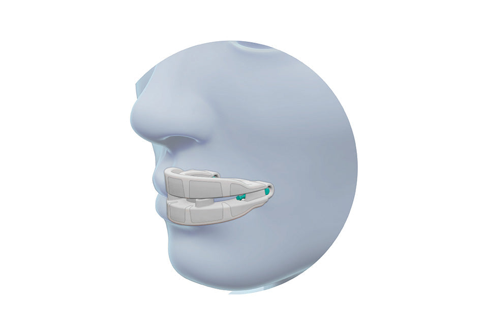 Anti Snoring Mouthpiece Device - image 3