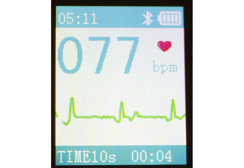 Portable Smart Bluetooth EKG Monitor - image 5