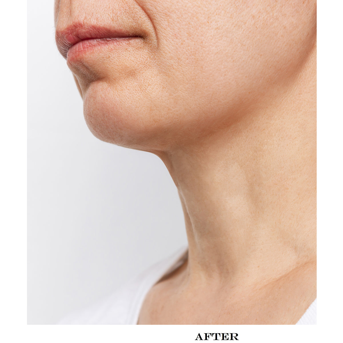 Wrinkle Reducing Neck Therapy Device - image 6