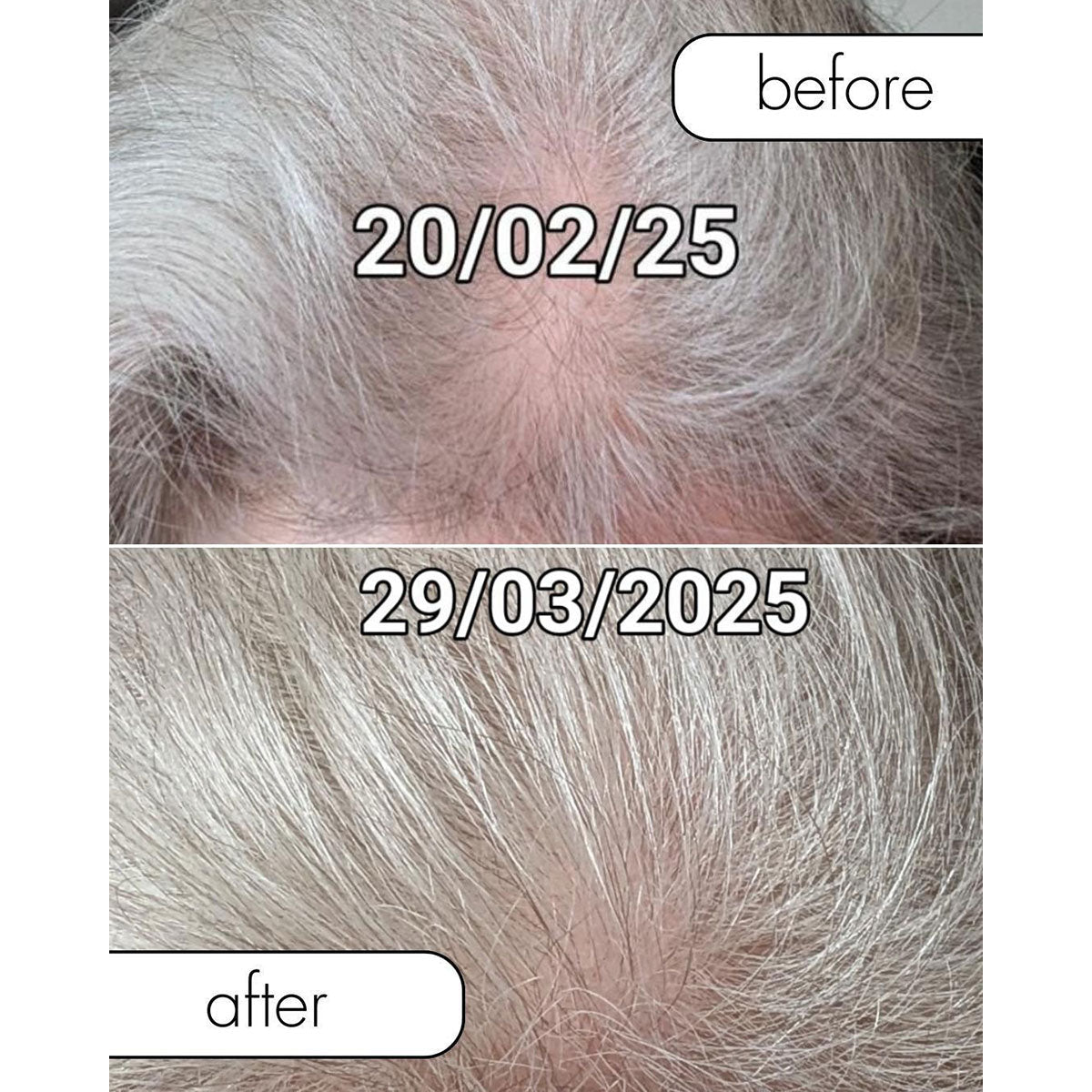 Wireless Hair Growth Brush - image 3