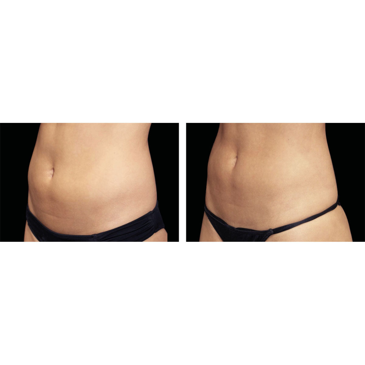 5-in-1 Body Contouring Device - image 6
