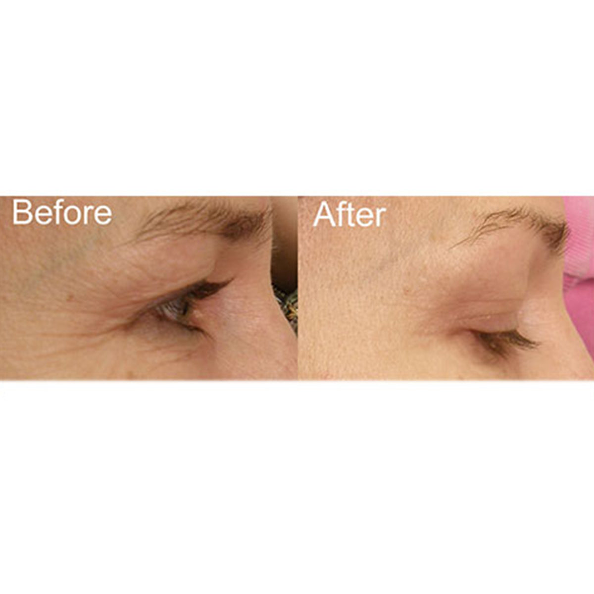 Full Face Professional Light Therapy System - image 3
