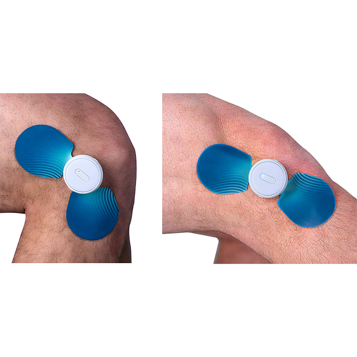 iTens Wearable Electrotherapy - image 5