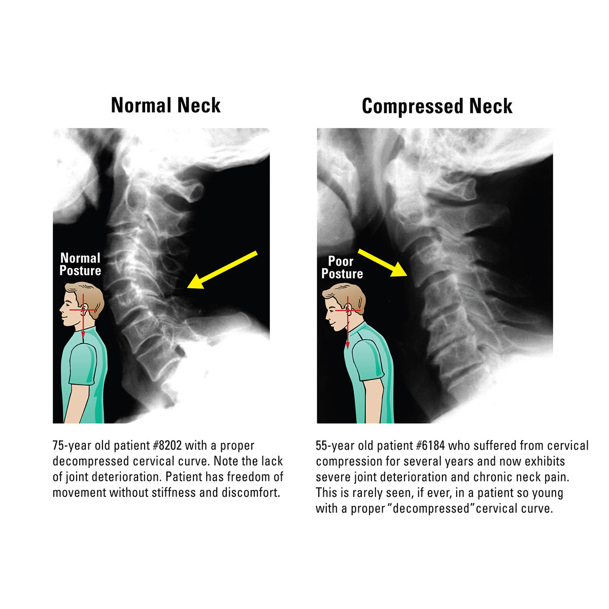 At Home Neck and Back Pain Reliever - image 3