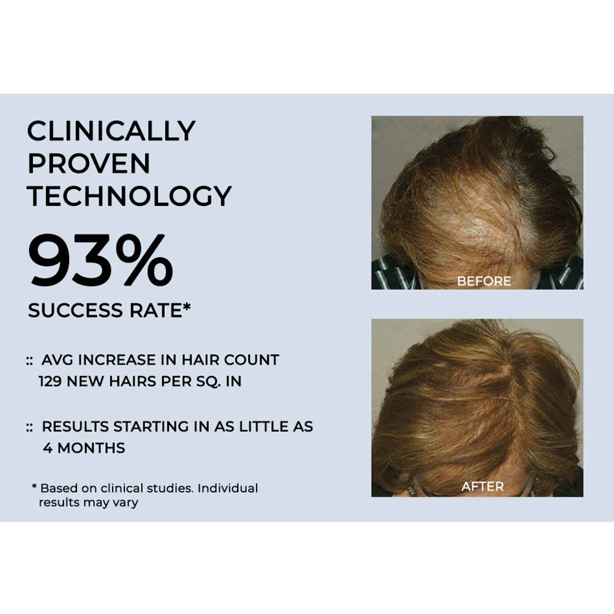 Cordless Hair Growth Comb - image 6
