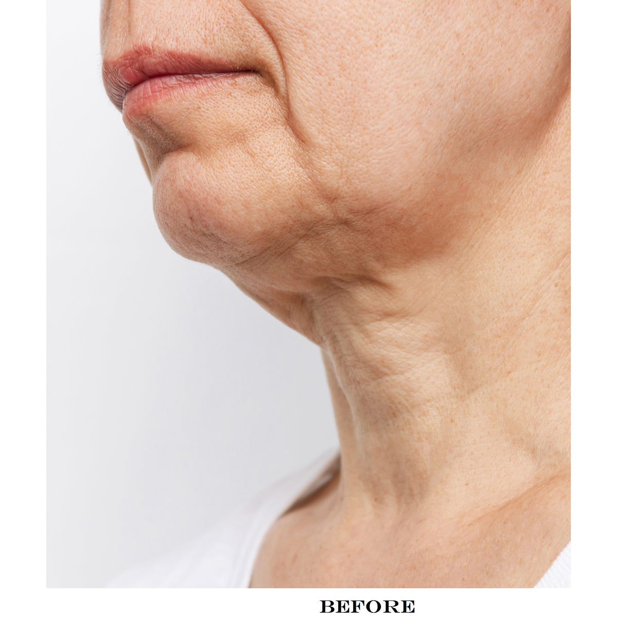 Wrinkle Reducing Neck Therapy Device - image 5