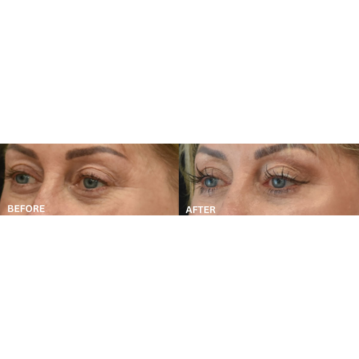 EMS & Heat Therapy Silicone Eye Mask - image 6